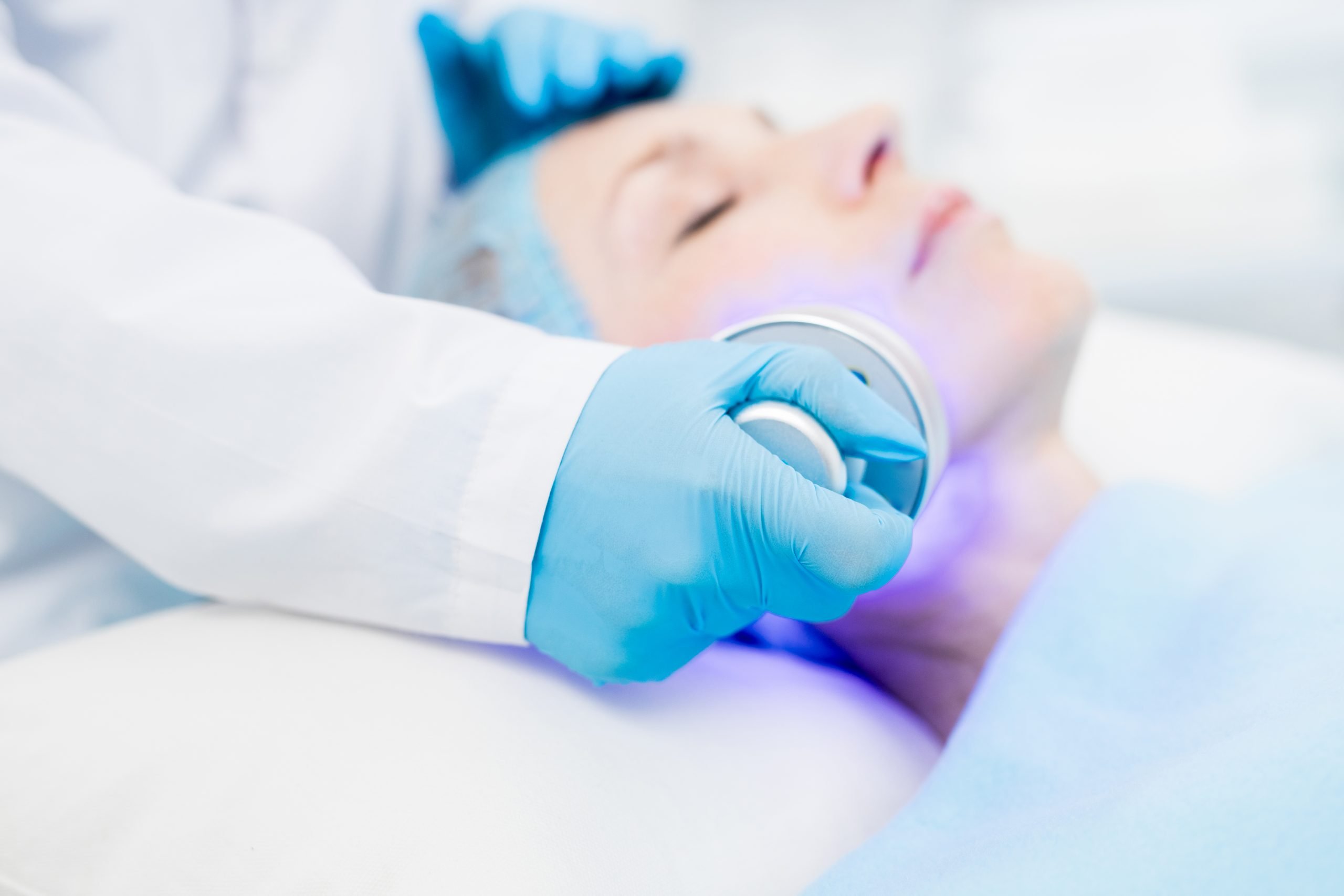 laser marking for medical device